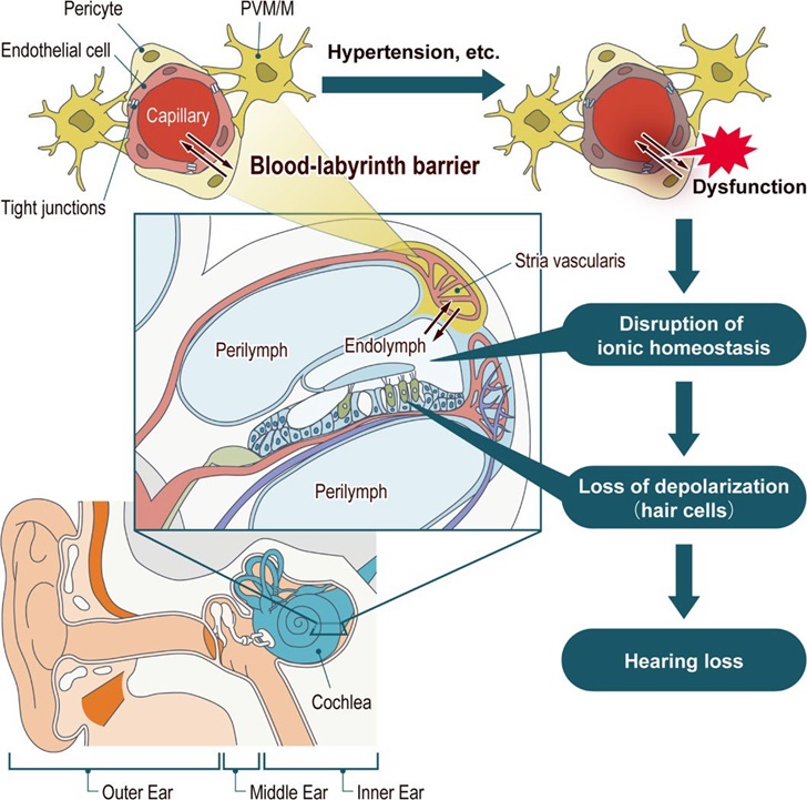 basic tinnitus, tinnitusweb, tinitus dasar teori