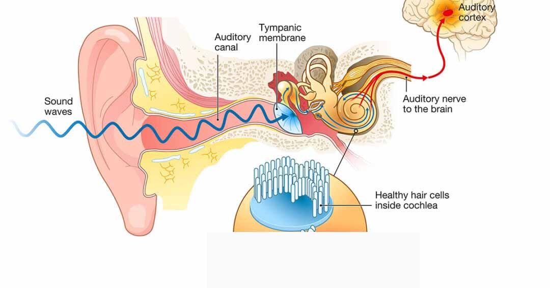 basic tinnitus, tinnitusweb, tinitus dasar teori